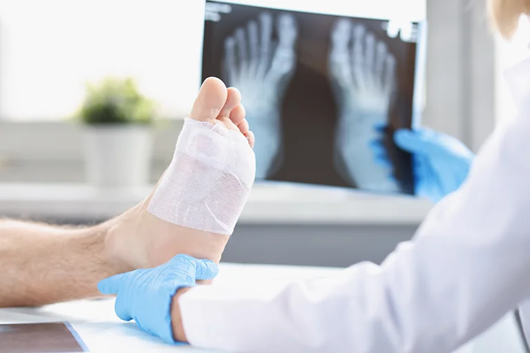 Chesapeake Research Center Foot and Ankle Center - bandaged foot with x-ray
